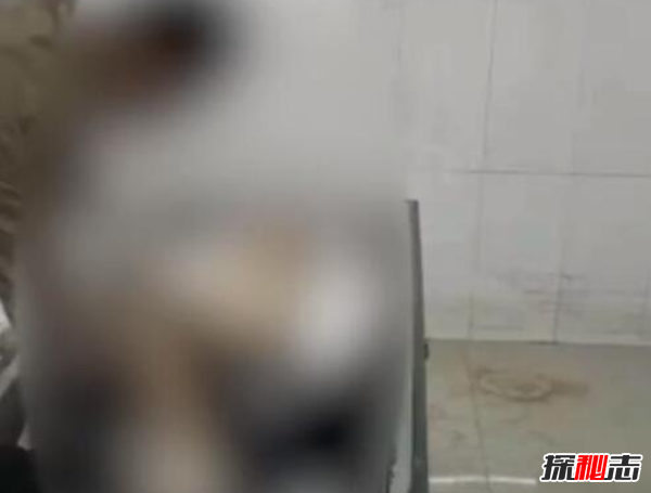 湖南太平間遺體雙眼被挖?到底是什么原因